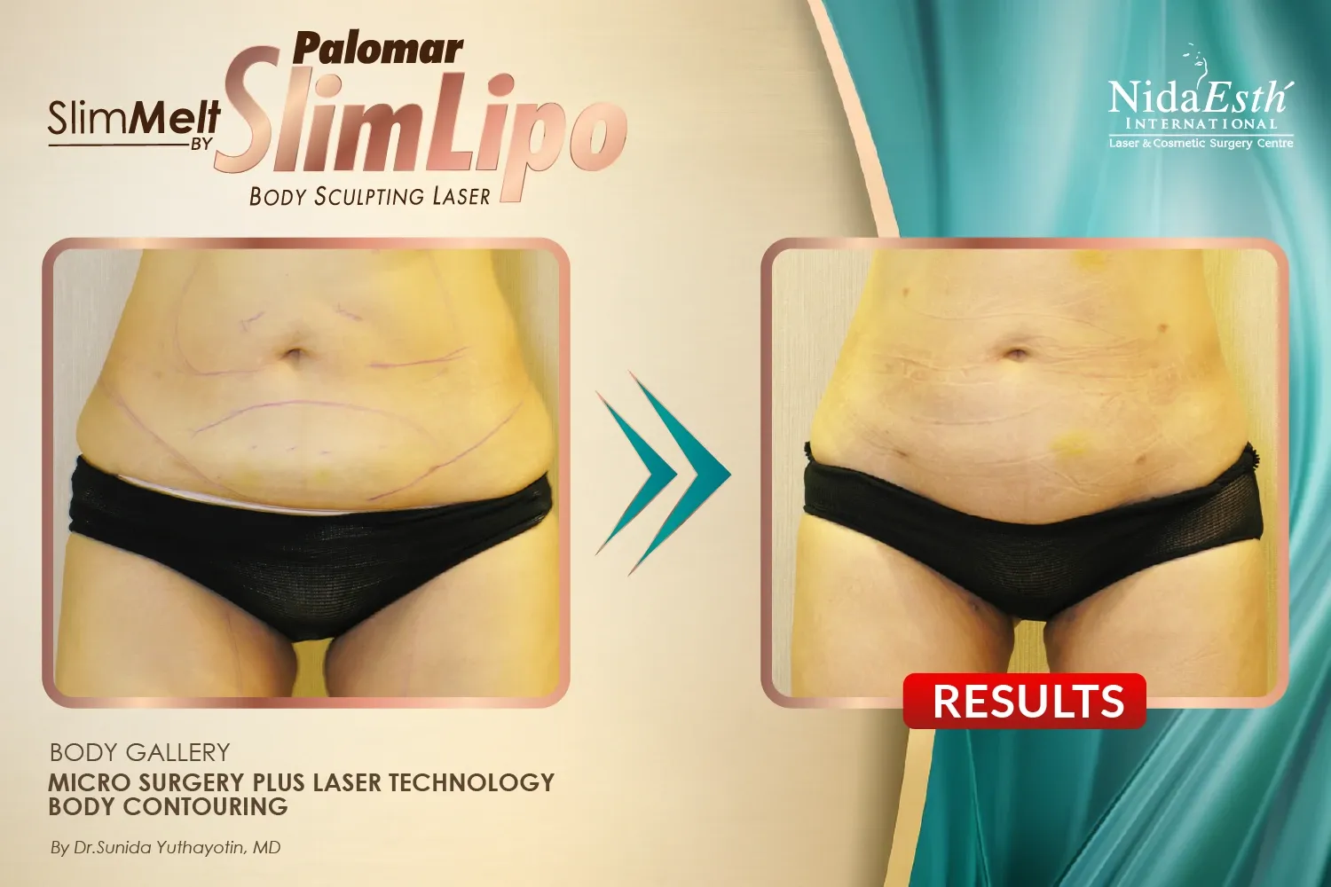 imgi_13_Slim-02