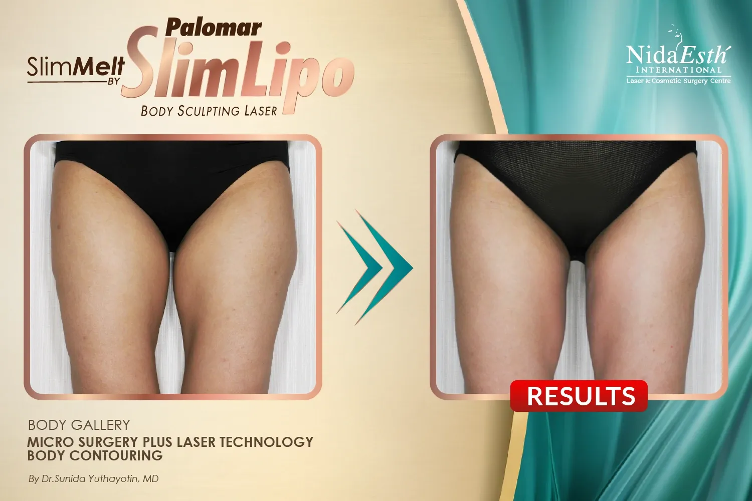 imgi_14_Slim-03