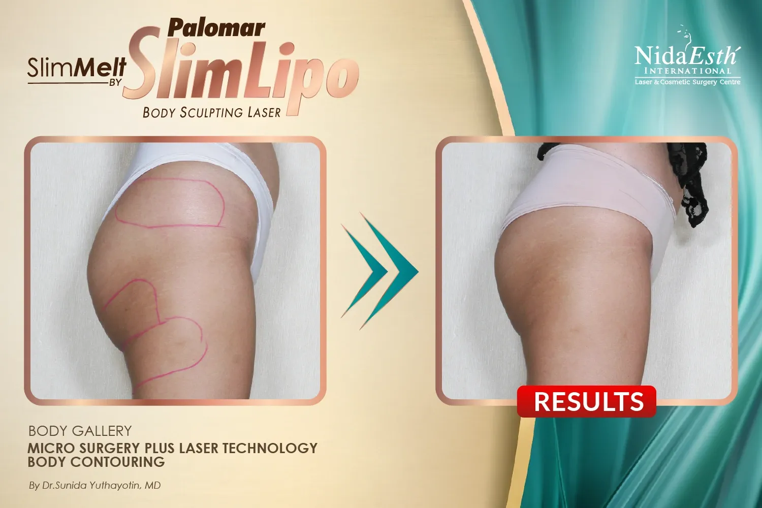 imgi_15_Slim-04