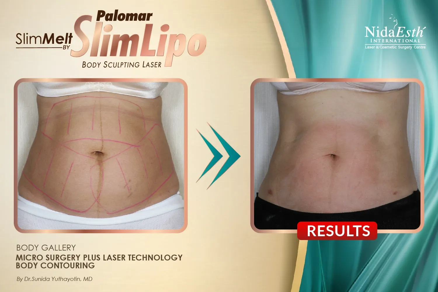 imgi_16_Slim-05